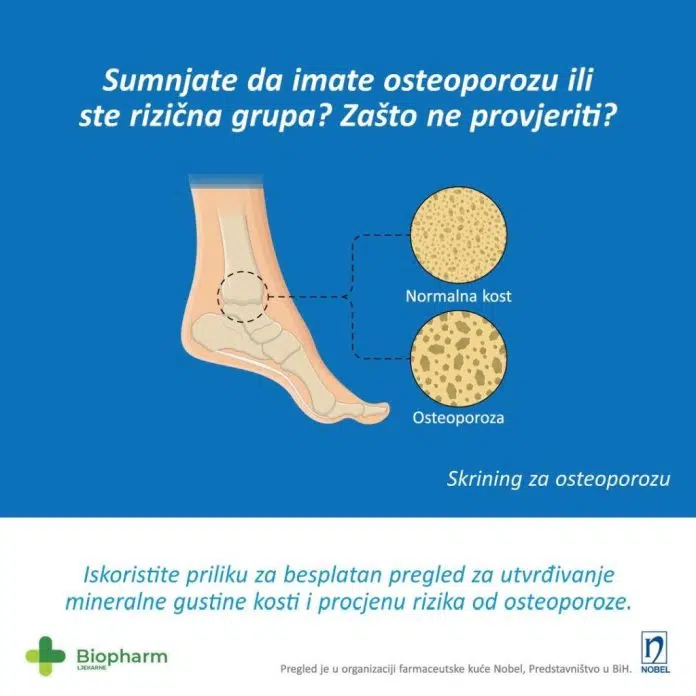 1721769868 Sumnjate Da Imate Osteoporozu Posjetite Ljekarne Biopharm U Tomislavgradu I