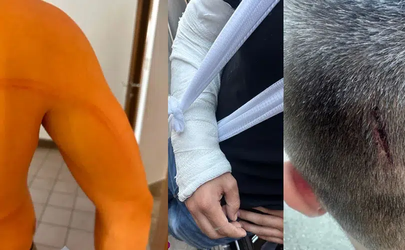 MLadići iz Širokog Brijega tvrde da su ih policajci brutalno pretukli.