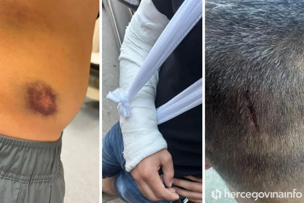 Mladići iz Širokog Brijega koji su pretučeni idu na saslušanje