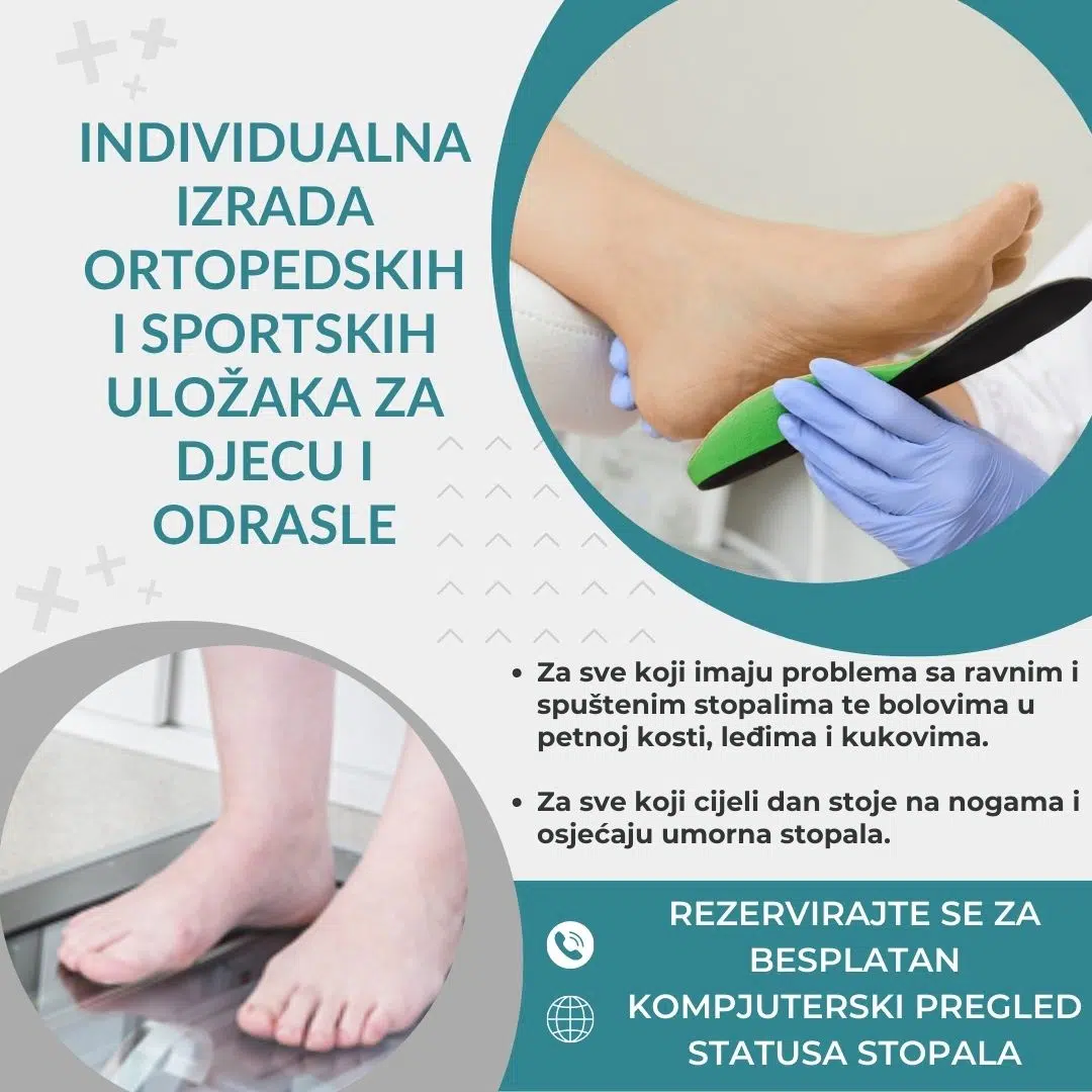 Besplatno skeniranje stopala u Biopharm ljekarni u Neumu