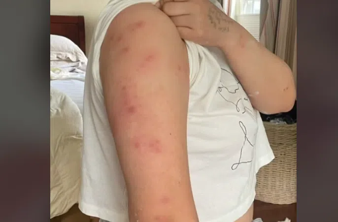 Loše iskustvo u hotelskoj sobi